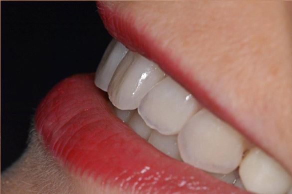 fig-4.jpg
