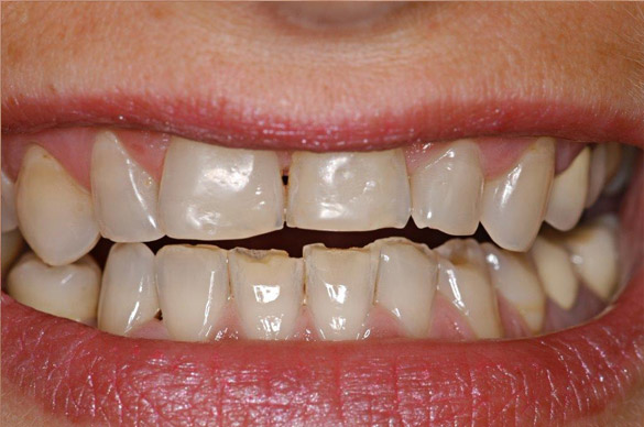 fig-2.jpg